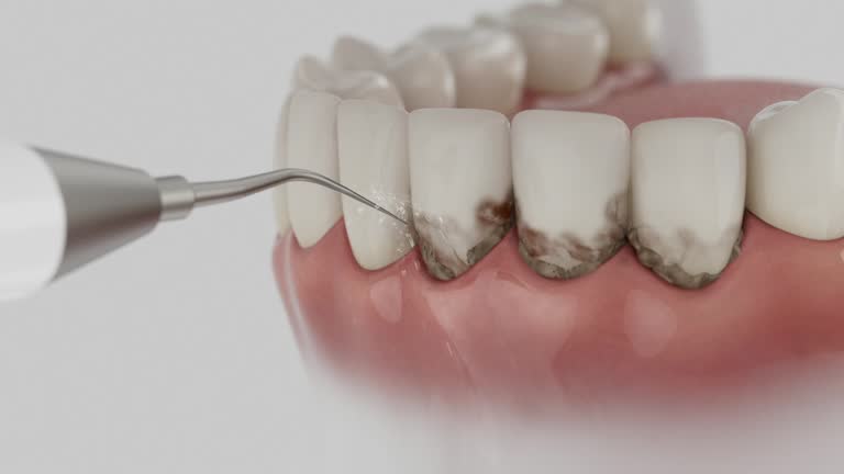 Reliable Dental Implants contractor in Despard, WV by Smile Center Dentistry